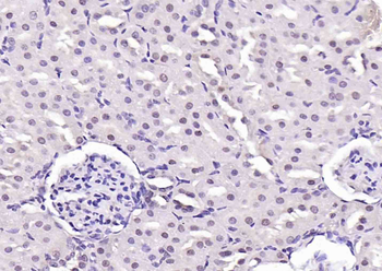 HIF-1 Alpha Rabbit Polyclonal Antibody