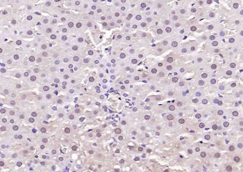 HIF-1 Alpha Rabbit Polyclonal Antibody