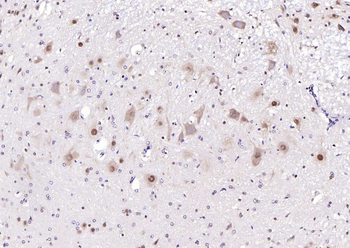HRG1 Rabbit Polyclonal Antibody