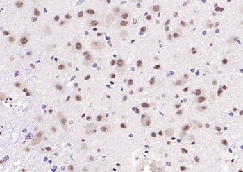 HRG1 Rabbit Polyclonal Antibody
