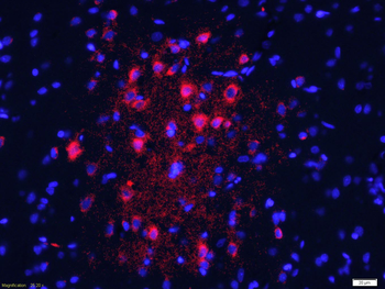 HRG1 Rabbit Polyclonal Antibody