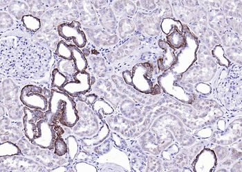 EMP-1 Rabbit Polyclonal Antibody