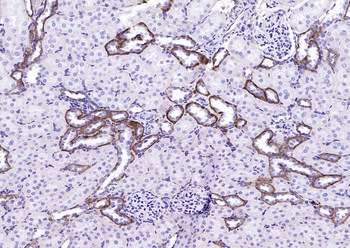 EMP-1 Rabbit Polyclonal Antibody