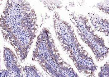 EMP-1 Rabbit Polyclonal Antibody