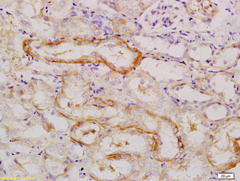 E cadherin Rabbit Polyclonal Antibody