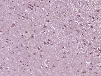 MDM2 Rabbit Polyclonal Antibody