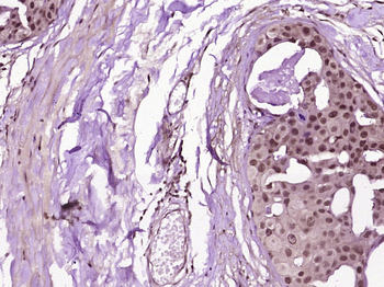 MDM2 Rabbit Polyclonal Antibody