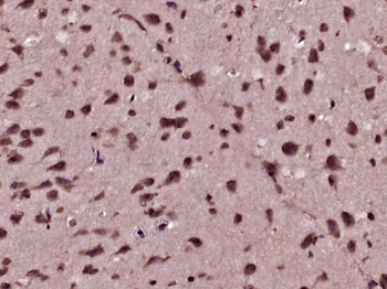 MDM2 Rabbit Polyclonal Antibody