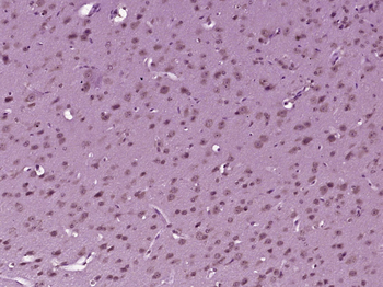 MDM2 Rabbit Polyclonal Antibody