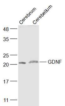 GDNF Rabbit Polyclonal Antibody