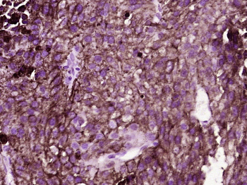 MC1R Rabbit Polyclonal Antibody