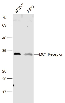 MC1R Rabbit Polyclonal Antibody