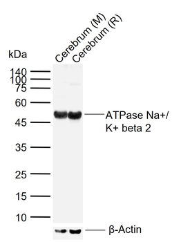 ATP1B2 Rabbit Polyclonal Antibody