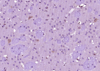 STAT3 Mouse Monoclonal Antibody