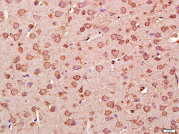STAT3 Mouse Monoclonal Antibody