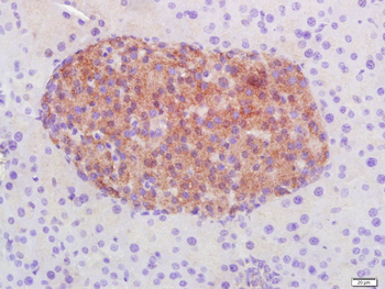 STAT3 Mouse Monoclonal Antibody