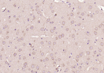 STAT3 Mouse Monoclonal Antibody