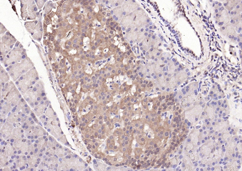 STAT3 Mouse Monoclonal Antibody