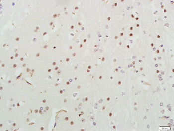 PIK3R1 Mouse Monoclonal Antibody
