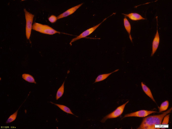 PIK3R1 Mouse Monoclonal Antibody