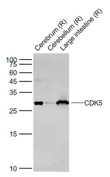 CDK5 Rabbit Polyclonal Antibody