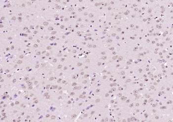CDK5 Rabbit Polyclonal Antibody