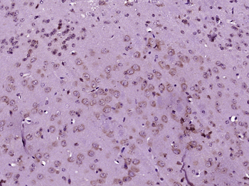 CDK5 Rabbit Polyclonal Antibody