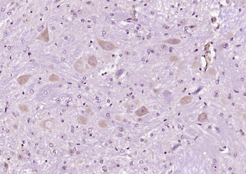 CDK5 Rabbit Polyclonal Antibody