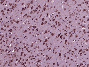 CDK5 Rabbit Polyclonal Antibody
