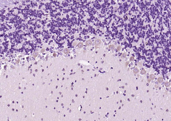 CDK5 Rabbit Polyclonal Antibody