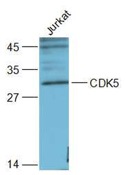 CDK5 Rabbit Polyclonal Antibody