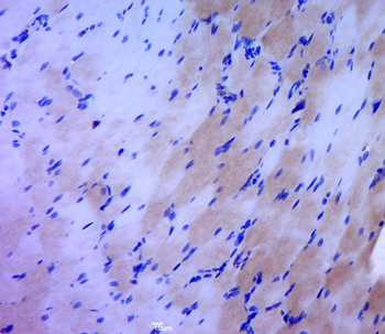 UCP-2 Rabbit Polyclonal Antibody