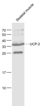 UCP-2 Rabbit Polyclonal Antibody
