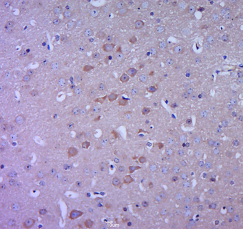GPR49/LGR5 Rabbit Polyclonal Antibody