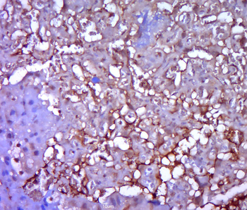 GPR49/LGR5 Rabbit Polyclonal Antibody