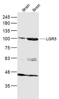GPR49/LGR5 Rabbit Polyclonal Antibody