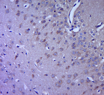 5HT2A Receptor Rabbit Polyclonal Antibody