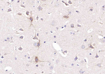 5HT2A Receptor Rabbit Polyclonal Antibody