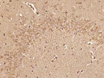 5HT2A Receptor Rabbit Polyclonal Antibody
