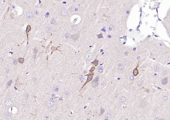 5HT2A Receptor Rabbit Polyclonal Antibody