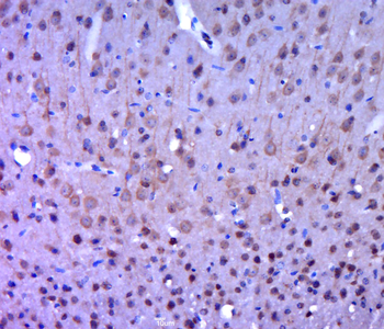 FAK Rabbit Polyclonal Antibody