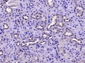FAK Rabbit Polyclonal Antibody