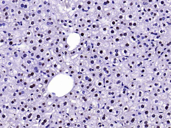 FAK Rabbit Polyclonal Antibody