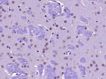 FAK Rabbit Polyclonal Antibody