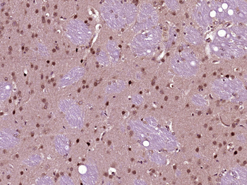 FAK Rabbit Polyclonal Antibody