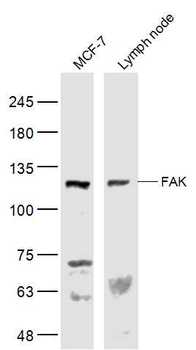 FAK Rabbit Polyclonal Antibody