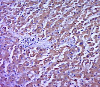 FAK Rabbit Polyclonal Antibody