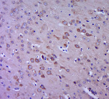 FAK Rabbit Polyclonal Antibody