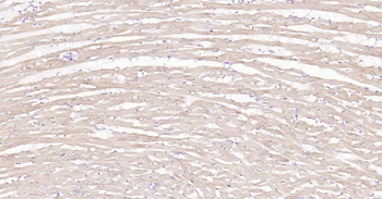 DDIT3 Rabbit Polyclonal Antibody