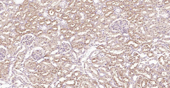 DDIT3 Rabbit Polyclonal Antibody